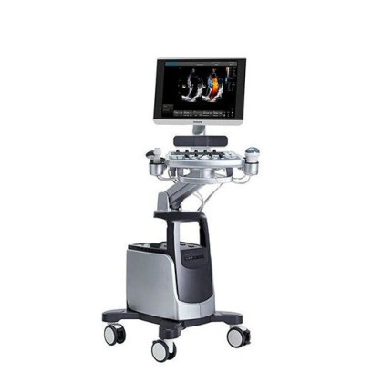 УЗИ аппарат Chison i6 Фото товара УЗИ аппарат Chison i6
