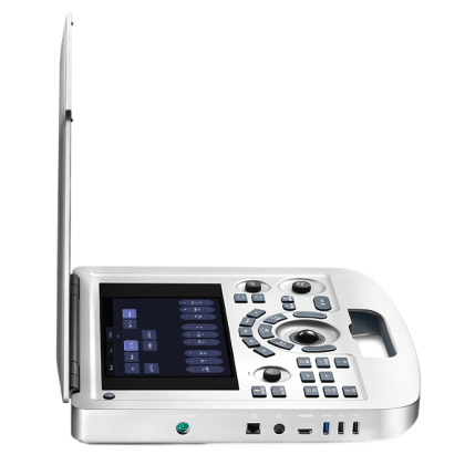 УЗИ аппарат Edan Acclarix AX3 Фото товара УЗИ аппарат Edan Acclarix AX3