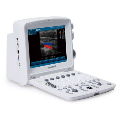УЗИ аппарат Edan U50 Prime Edition Фото товара УЗИ аппарат Edan U50 Prime Edition