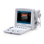 УЗИ аппарат Edan U50 Prime Edition Фото товара УЗИ аппарат Edan U50 Prime Edition