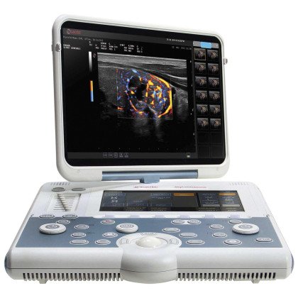 УЗИ аппарат Esaote MyLab Gamma Фото товара УЗИ аппарат Esaote MyLab Gamma