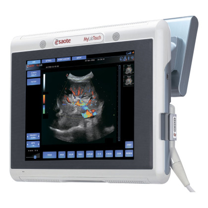 УЗИ аппарат Esaote MyLab One Фото товара УЗИ аппарат Esaote MyLab One