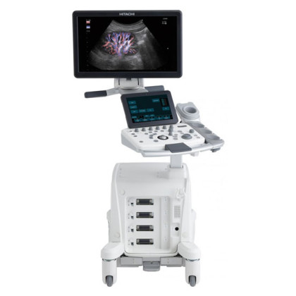 Фото товара УЗИ аппарат Fujifilm (Hitachi) Arietta 50 / 50LE
