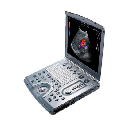 УЗИ аппарат GE Healthcare Voluson I Фото товара УЗИ аппарат GE Healthcare Voluson I