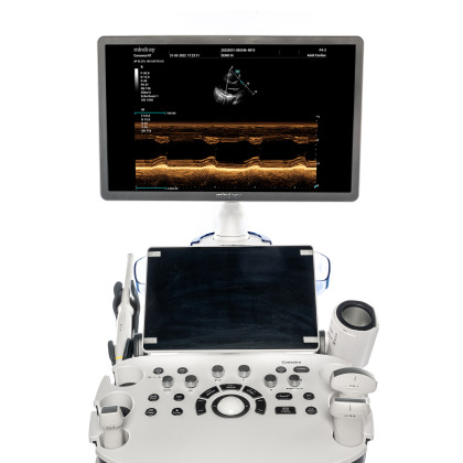 УЗИ аппарат Mindray Consona N7 Фото товара УЗИ аппарат Mindray Consona N7