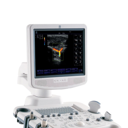 УЗИ аппарат Mindray DC-3 Фото товара УЗИ аппарат Mindray DC-3