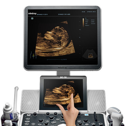 Фото товара УЗИ аппарат Mindray DC-70S