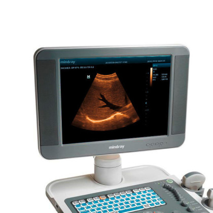 УЗИ аппарат Mindray DP-5 Фото товара УЗИ аппарат Mindray DP-5