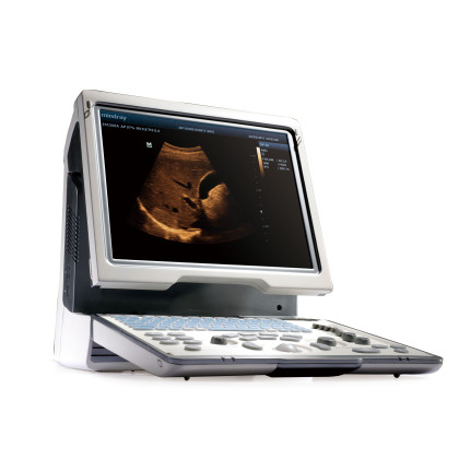 Фото товара УЗИ аппарат Mindray DP-50 Color