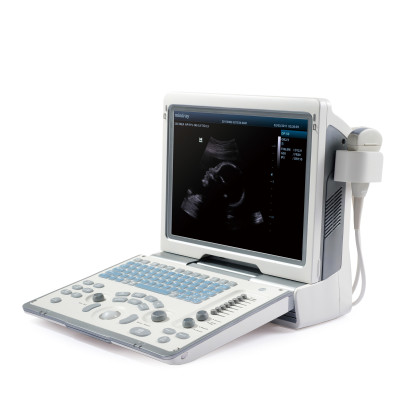Фото товара УЗИ аппарат Mindray DP-50