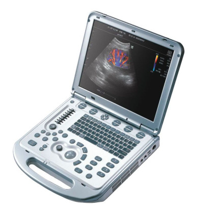УЗИ аппарат Mindray M7 Premium Фото товара УЗИ аппарат Mindray M7 Premium