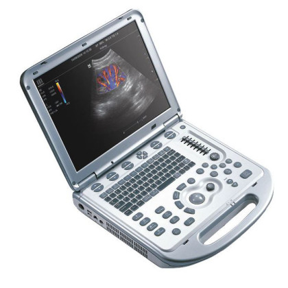 УЗИ аппарат Mindray M7 Premium Фото товара УЗИ аппарат Mindray M7 Premium