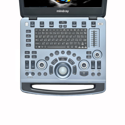Фото товара УЗИ аппарат Mindray M8 портативный