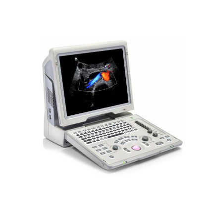 УЗИ аппарат Mindray Z6 Фото товара УЗИ аппарат Mindray Z6