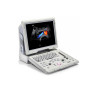 УЗИ аппарат Mindray Z6 Фото товара УЗИ аппарат Mindray Z6
