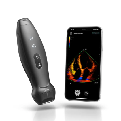 УЗИ аппарат Mindray ТЕ Air i3P Фото товара УЗИ аппарат Mindray ТЕ Air i3P