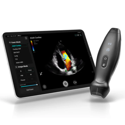 УЗИ аппарат Mindray ТЕ Air i3P Фото товара УЗИ аппарат Mindray ТЕ Air i3P