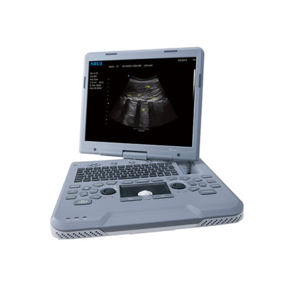 Фото товара УЗИ аппарат SIUI Apogee 1000 Neo