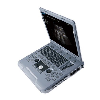 Фото товара УЗИ аппарат SIUI Apogee 1000 Neo