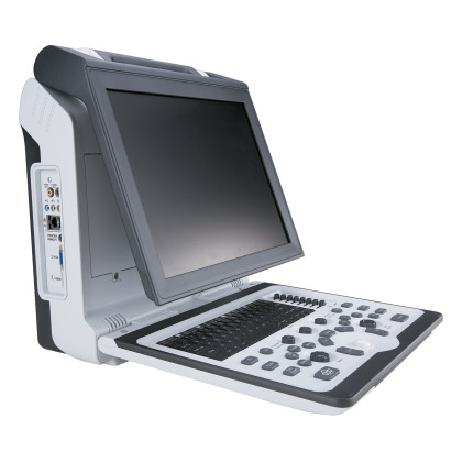 Фото товара УЗИ аппарат SIUI Apogee 1100