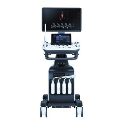 УЗИ аппарат РуСкан 65 Фото товара УЗИ аппарат РуСкан 65