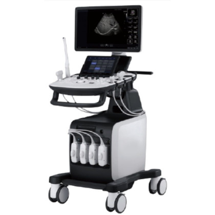 УЗИ аппарат РуСкан 65 Фото товара УЗИ аппарат РуСкан 65