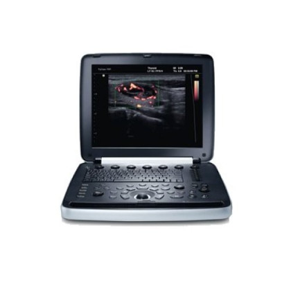 УЗИ аппарат РуСкан 70П Фото товара УЗИ аппарат РуСкан 70П