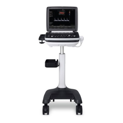 УЗИ аппарат РуСкан 70П Фото товара УЗИ аппарат РуСкан 70П