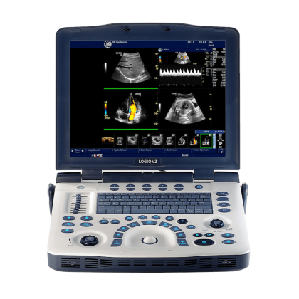 Фото товара Ультразвуковая диагностическая система GE Healthcare LOGIQ V2