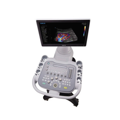 Ультразвуковая диагностическая система SIUI Apogee 3300 Neo Фото товара Ультразвуковая диагностическая система SIUI Apogee 3300 Neo