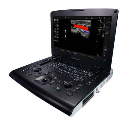 Фото товара Ультразвуковая система GE Versana Active