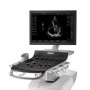 Ультразвуковая система GE Versana Balance Фото товара Ультразвуковая система GE Versana Balance
