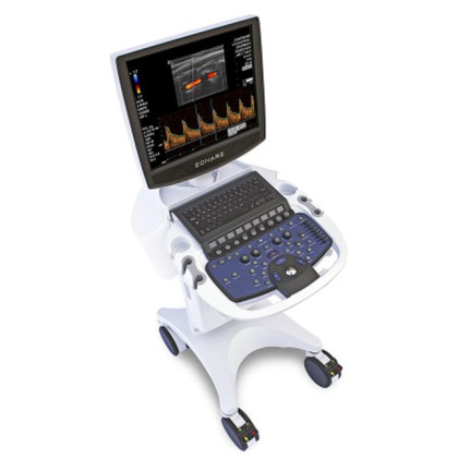 Ультразвуковая система премиум-класса Zonare ZS3 Фото товара Ультразвуковая система премиум-класса Zonare ZS3