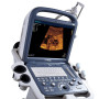 Ультразвуковой аппарат SonoScape S2 Фото товара Ультразвуковой аппарат SonoScape S2