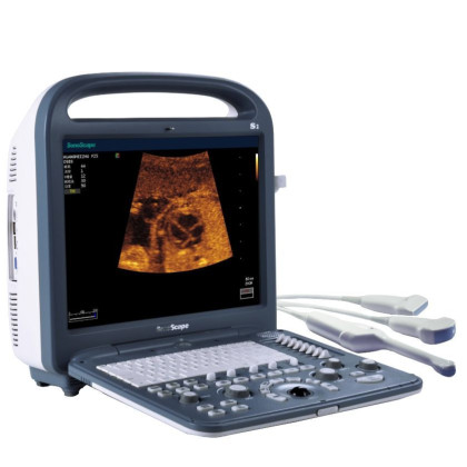 Ультразвуковой аппарат SonoScape S2 Фото товара Ультразвуковой аппарат SonoScape S2