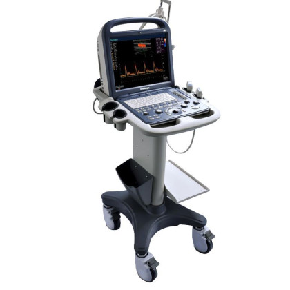 Ультразвуковой аппарат SonoScape S2 Фото товара Ультразвуковой аппарат SonoScape S2