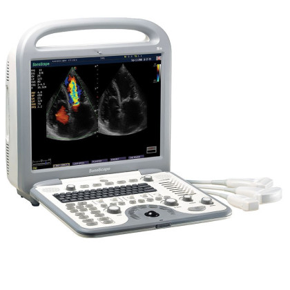 Ультразвуковой аппарат SonoScape S8 Фото товара Ультразвуковой аппарат SonoScape S8
