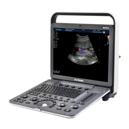 Ультразвуковой аппарат SonoScape S8Exp Фото товара Ультразвуковой аппарат SonoScape S8Exp