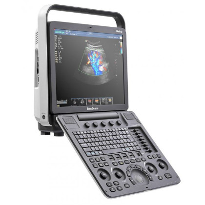 Ультразвуковой аппарат SonoScape S8Exp Фото товара Ультразвуковой аппарат SonoScape S8Exp