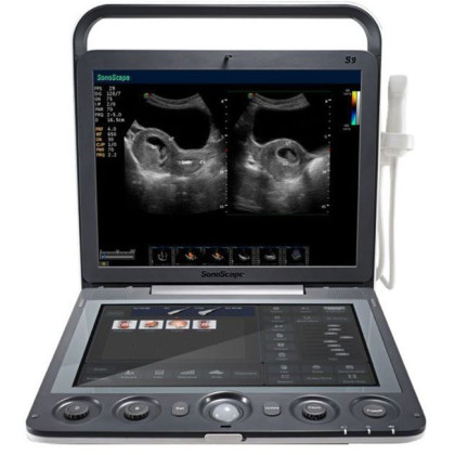 Ультразвуковой аппарат SonoScape S9 Фото товара Ультразвуковой аппарат SonoScape S9