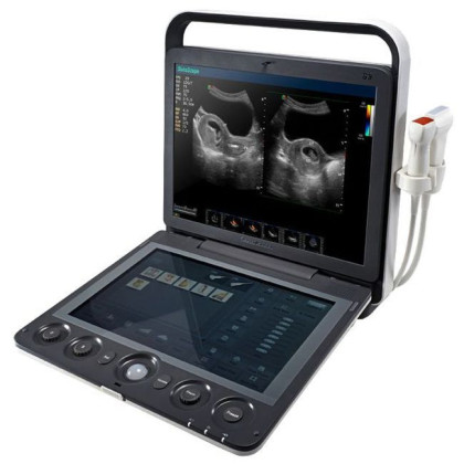 Ультразвуковой аппарат SonoScape S9 Фото товара Ультразвуковой аппарат SonoScape S9