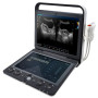 Ультразвуковой аппарат SonoScape S9 Фото товара Ультразвуковой аппарат SonoScape S9