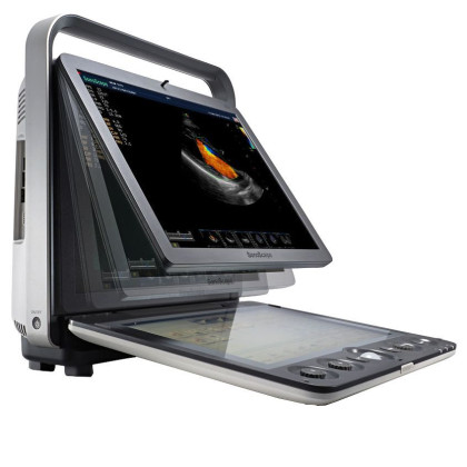 Ультразвуковой аппарат SonoScape S9Pro Фото товара Ультразвуковой аппарат SonoScape S9Pro