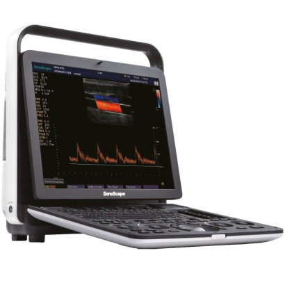 Ультразвуковой аппарат SonoScape S9Pro Фото товара Ультразвуковой аппарат SonoScape S9Pro