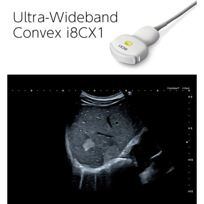 Фото товара Ультразвуковой сканер Canon Aplio i700