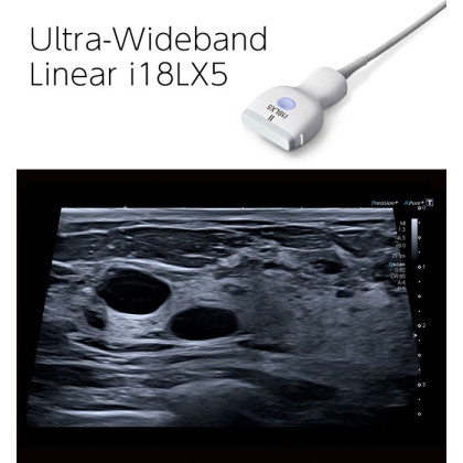 Фото товара Ультразвуковой сканер Canon Aplio i700