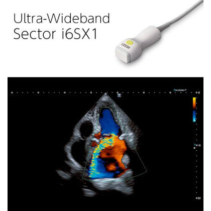 Фото товара Ультразвуковой сканер Canon Aplio i700