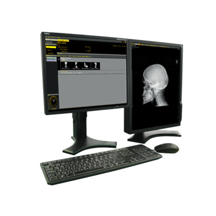 Фото товара Универсальный рентгенографический аппарат МТЛ «УнивеРС-Флюорограф-МТ»