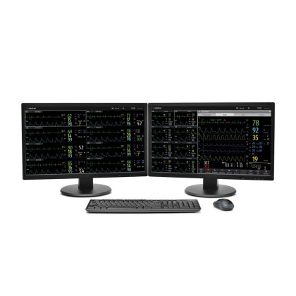 Центральная станция мониторинга Mindray BeneVision CMS Фото товара Центральная станция мониторинга Mindray BeneVision CMS