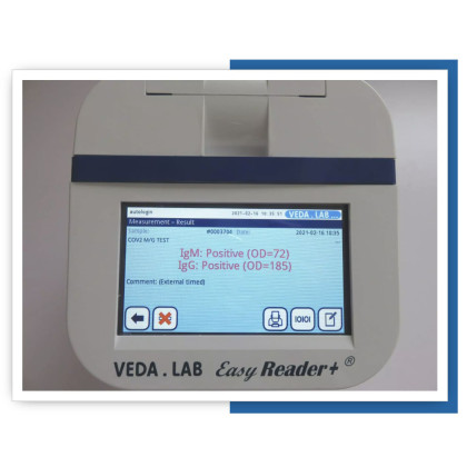 Фото товара Экспресс-анализатор иммунохроматографический Easy Reader+